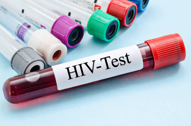 HIV enfeksiyonunda uzmanlar, Türkiye’deki rakamların endişe vermeye başladığını belirtti