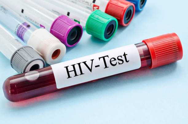 HIV ve AIDS Nedir?