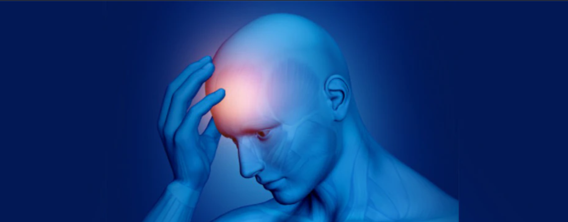 Kronik Migren Nasıl Tedavi Edilir?